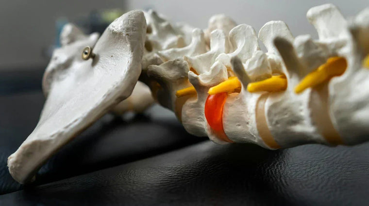 What Is the Sciatic Nerve, and the Three Places It Can Get Pinched