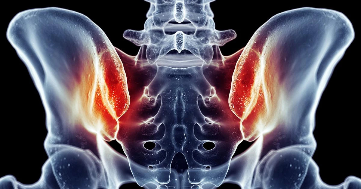 Everything You Need to Know About the Sacroiliac Joints and Sacroiliac Joint Pain