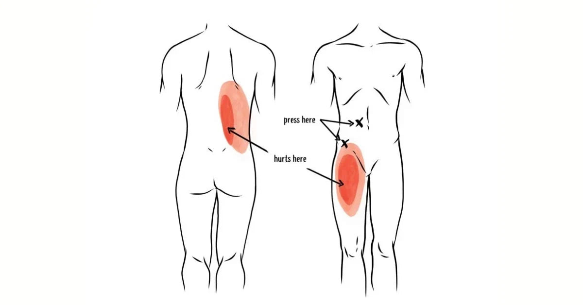 Are trigger points the cause of your muscle pain?