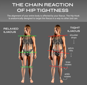 Diagram showing the chain reaction of hip tightness with anatomical illustrations and text.
