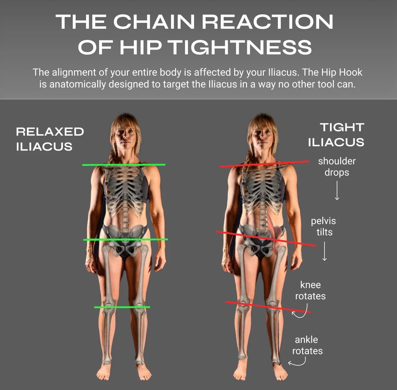 Alignment affects of muscle tension